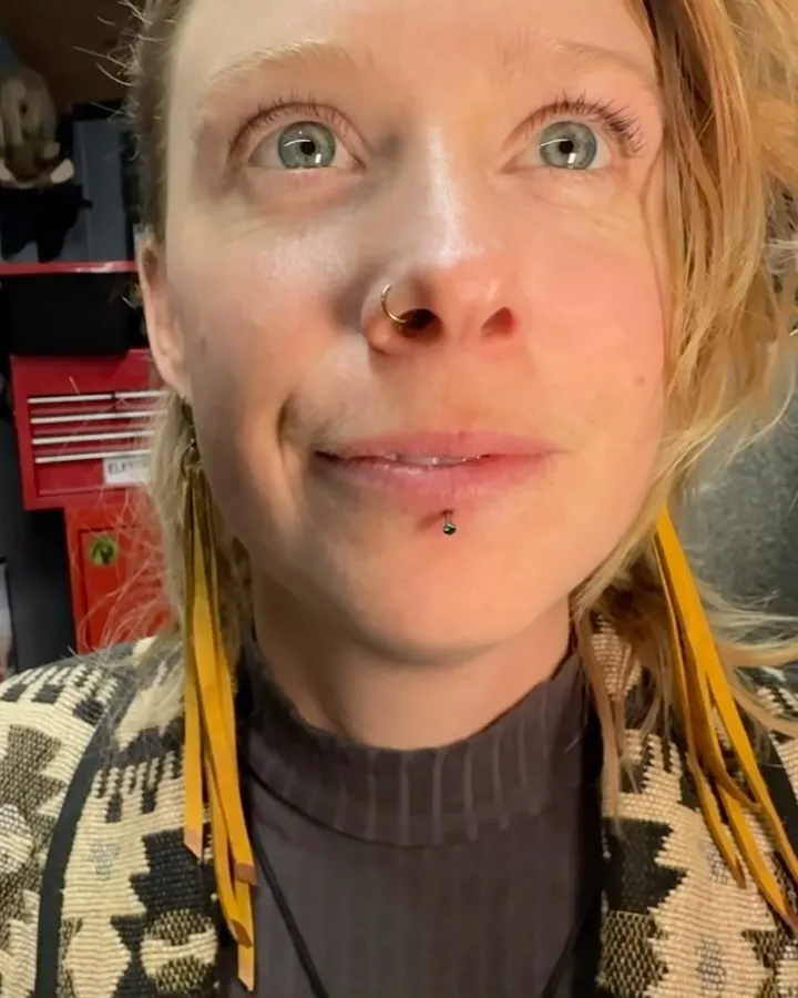 Lip labret piercing, healed